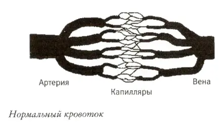 Независимо от механической природы нарушения работы сосудов будь то сгусток - фото 9