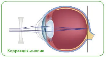 Частые головные боли повышенная зрительная утомляемость при работе за - фото 43
