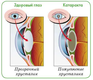 Хрусталик отвечает за фокусировку световых лучей и создание ясного и четкого - фото 120