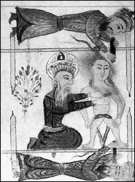 Операция Рисунок из книги по хирургии Шерафеддина Сабунджуоглу В городе - фото 159