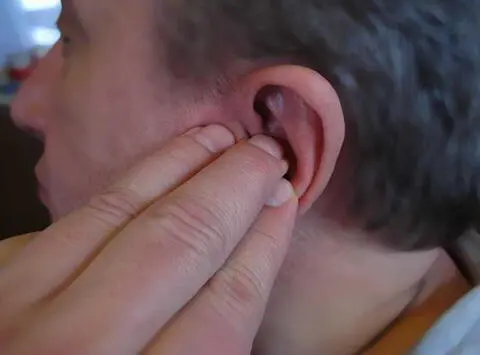 Таким способом хорошо лечить подзастуженные уши проблемы внутреннего уха Так - фото 8