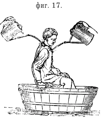 Особенно можно рекомендовать это обливаніе здоровымъ полнымъ людямъ Оно - фото 13