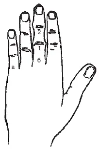 Рис 23Примеры различных форм пальцев Сильно выдающийся узел который - фото 28
