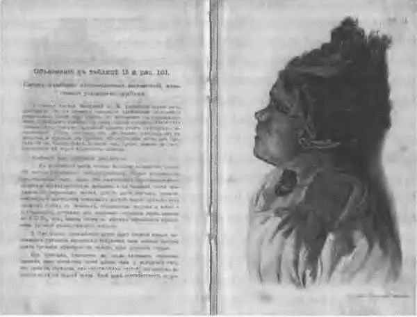 Рис 38 Иллюстрация из Атласа фон Гофмана к разделу Смерть вследствие - фото 37