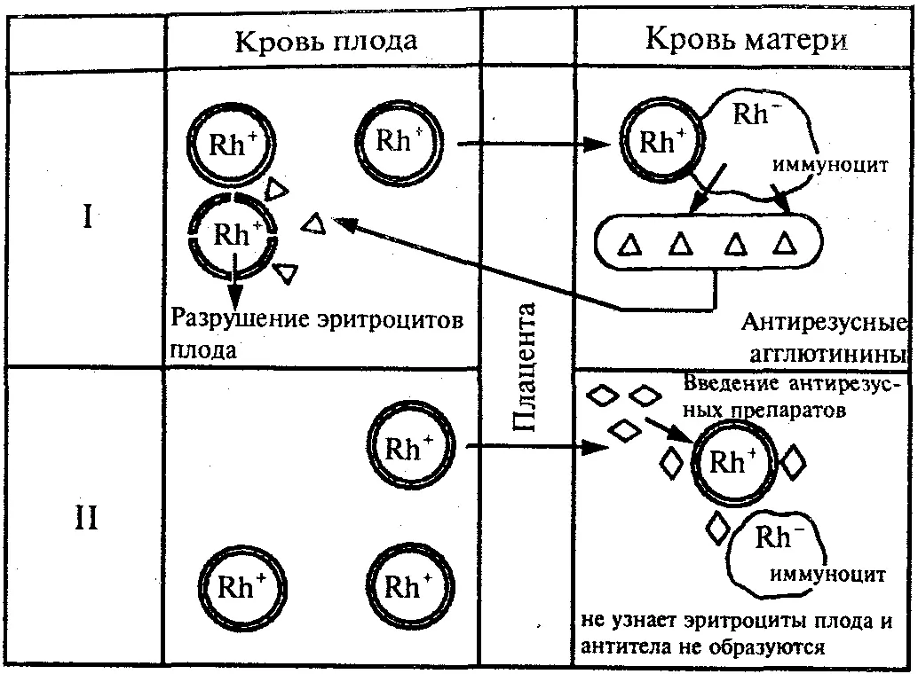 Рис 5 Развитие резусконфликта и его предотвращение I резусконфликт II - фото 6