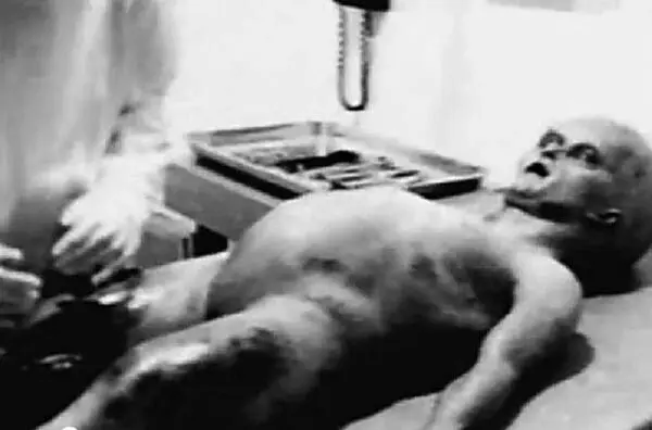 Кадр вскрытия тела инопланетянина из фильма Alien Autopsy Fact or Fiction - фото 68