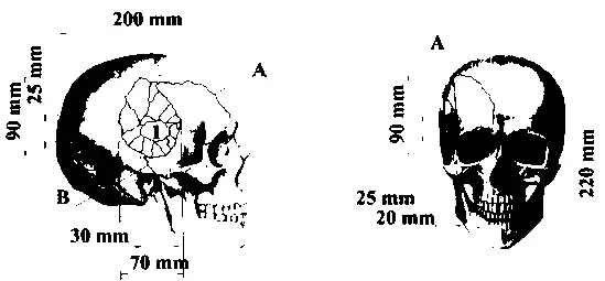 Схема повреждений черепа Николая ТибоБриньоля соотнесенная с размерностью - фото 71