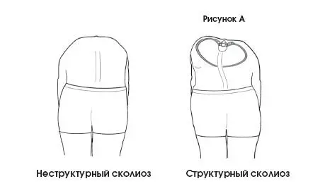 Изменения позвонков ребер и спинного мозга на эмбриональном уровне - фото 272