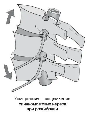 Лечение КОНСЕРВАТИВНОЕ ЛЕЧЕНИЕ Лекарственные средства анальгетики и - фото 275