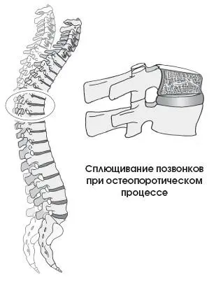 Причины Гормональные изменения У женщин в период после менопаузы существует - фото 287