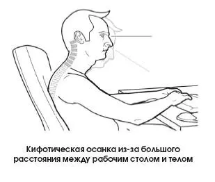Кифотическое положение влечет за собой смещение головы кпереди антепульсию - фото 324