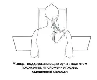 Таким образом изза длительного удержания веса рук иили веса головы при ее - фото 326
