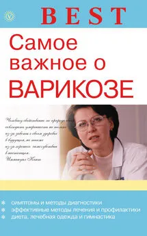 Ирина Малышева - Самое важное о варикозе