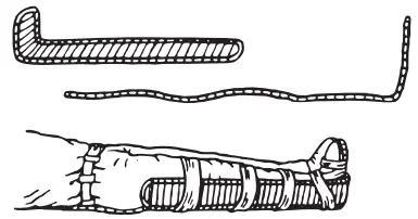 Рис 55 Иммобилизация голени при помощи лестничной шины Рис 56 - фото 7