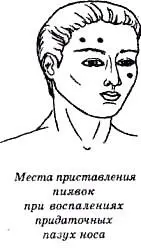 Данная группа заболеваний включает в себя воспалительные явления охватывающие - фото 50