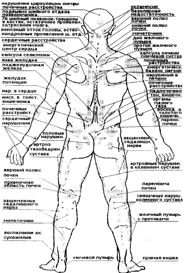 Рис 7 Диагностика нарушений в организме со стороны спины пациента - фото 8