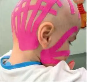 ж з Рис 37 Затейпировано 1 передняя группа мышц голеней mm tibialis - фото 89