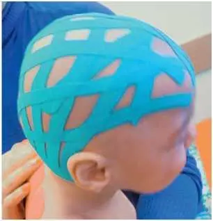 з Рис 37 Затейпировано 1 передняя группа мышц голеней mm tibialis - фото 90