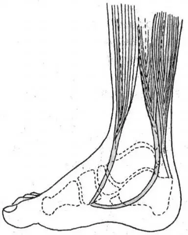 Рис 5 Анатомия стопы Анатомически стопа состоит их трех сводов или арок - фото 4