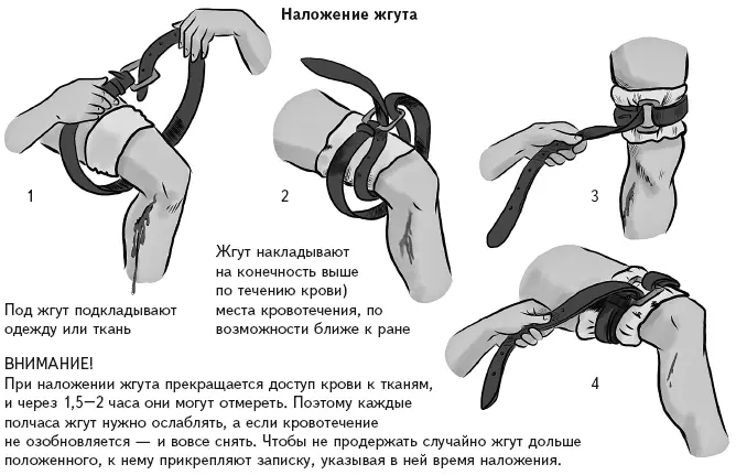 Подними повреждённую часть тела выше уровня сердца это тоже поможет - фото 142