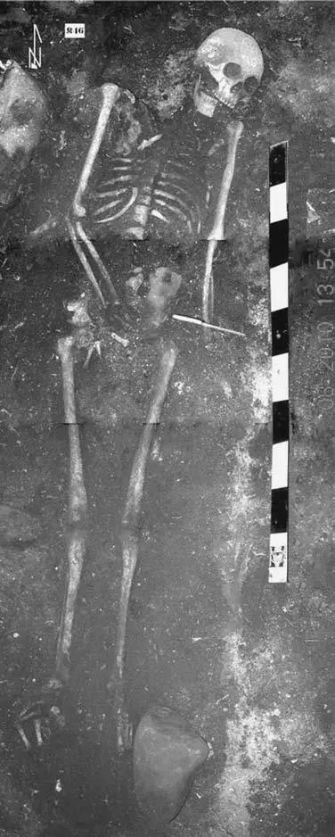 Рис 64 Фото погр К46 Права рука слабо согнута в локте кости ладони - фото 63