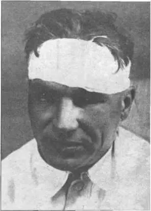 Валерий Чкалов после аварии 1935 г Восьмой километр Московского шоссе - фото 59