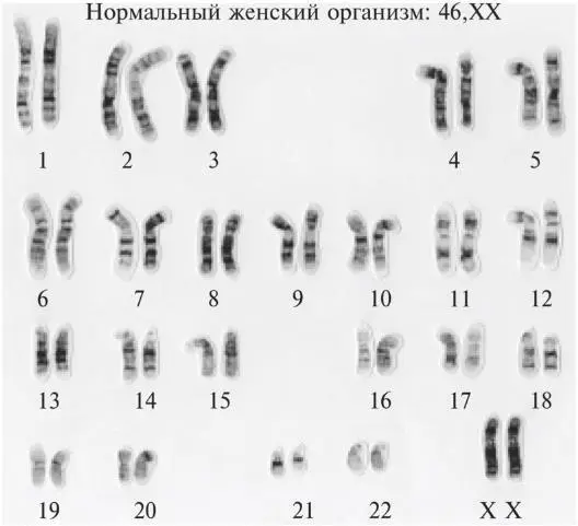 Рис 71Стандартные кариотипы женский и мужской показывают все хромосомы - фото 20