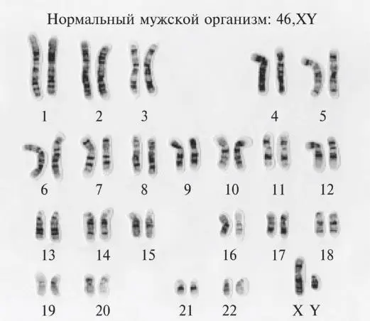 Рис 71Стандартные кариотипы женский и мужской показывают все хромосомы - фото 21