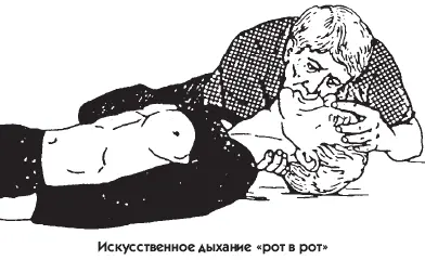 Положить больного на твердую ровную поверхность лучше на пол Большой - фото 23