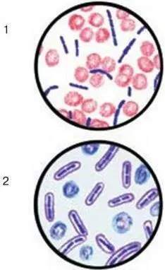 Рис 97 Возбудитель сибирской язвы Bacillus anthracis 1 в крови 2 - фото 278
