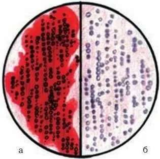 Рис 99 Рост на среде Эндо а Escherichia coli б Salmonella typhi - фото 279