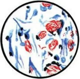 Рис 108 Mycobacterium leprae Окраска по методу ЦиляНильсена Рис 109 - фото 286