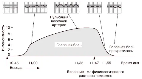 Рис 2 Приступ головной боли вызванный волнением и прекращенный с помощью - фото 2