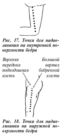 Надавливание на седалищный нерв в течение четырех минут рис 7 может - фото 11
