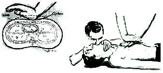 Искусственное дыхание способом рот в рот Стать на колени возле головы - фото 119