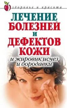 Екатерина Константинова - Лечение болезней и дефектов кожи. И жировик исчез, и бородавки