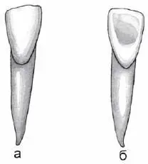 Рис 18 Латеральный резец нижней челюсти правый а вестибулярная норма б - фото 26