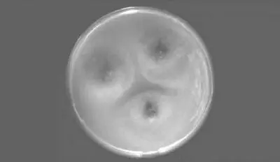 Рис 5Споры плесени под микроскопом Плесень убийца младенцев Загадочные - фото 5