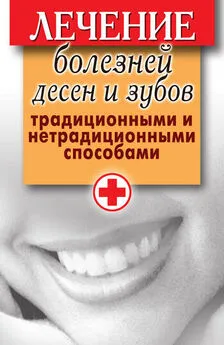 Елена Исаева - Лечение болезней десен и зубов традиционными и нетрадиционными способами