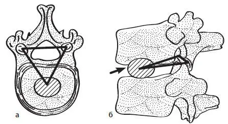 Рис 2Сочленения между телами позвонков articulatioон intersomatica и - фото 2