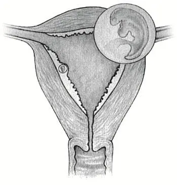 Эмбрион в возрасте 4 недель Когда зародыш внедряется в пронизанную - фото 15