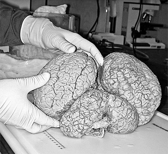 В нейроне сигналы переносятся с помощью электричества Внутренняя часть нейрона - фото 4