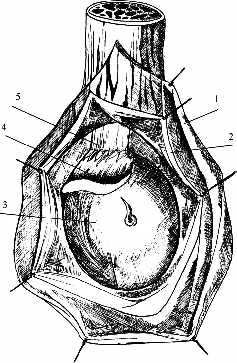 Рис 3 1 кожа 2 белочная оболочка 3 яичко 4 придаток яичка 5 - фото 5