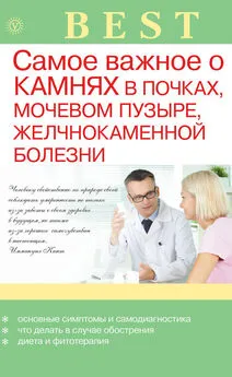 Александра Васильева - Самое важное о камнях в почках, мочевом пузыре, желчнокаменной болезни