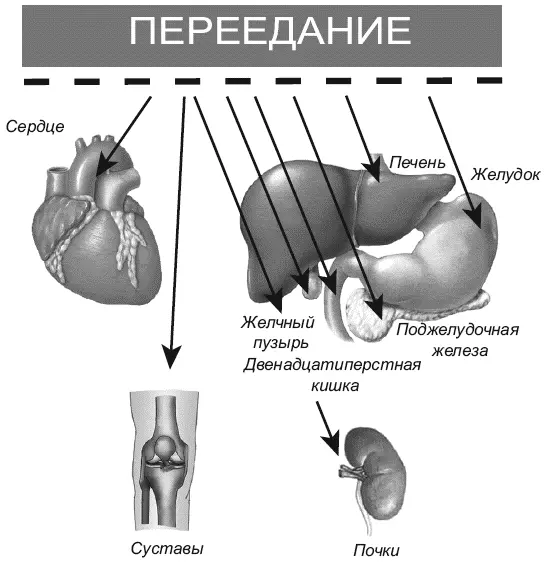 Рис 2 Избыточная масса тела путь к дегенеративным изменениям в организме - фото 3