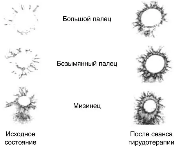 ГРВанализ В 1996 году сделано еще более важное открытие нервные клетки растут - фото 2