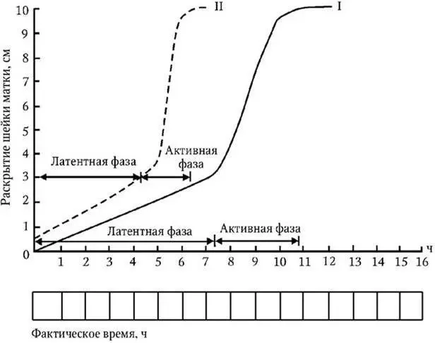 Рис 2 Партограмма I первородящие II повторнородящие Латентной фазой - фото 9