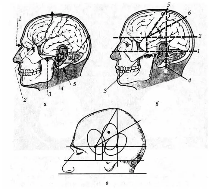 Рис 17 Схема краниометрии Крёнлейна а видимые и прощупываемые образования - фото 23