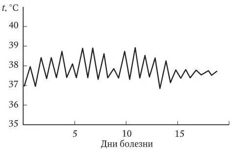 Рис 4 Температурная кривая ремиттирующего типа Рис 5 Температурная - фото 9