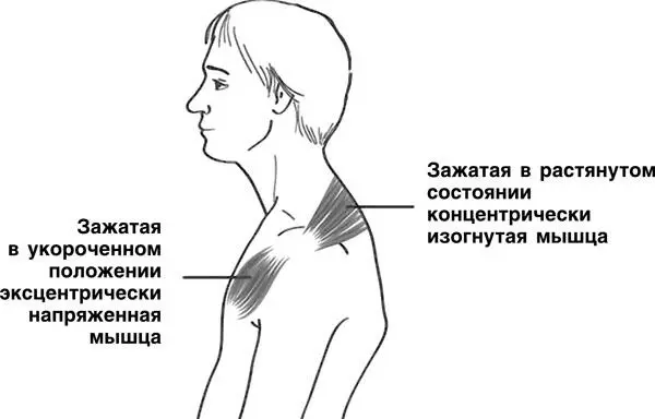 Рис 10 Дисбаланс мышц при сутулости Потому что заключаются они в том что - фото 10